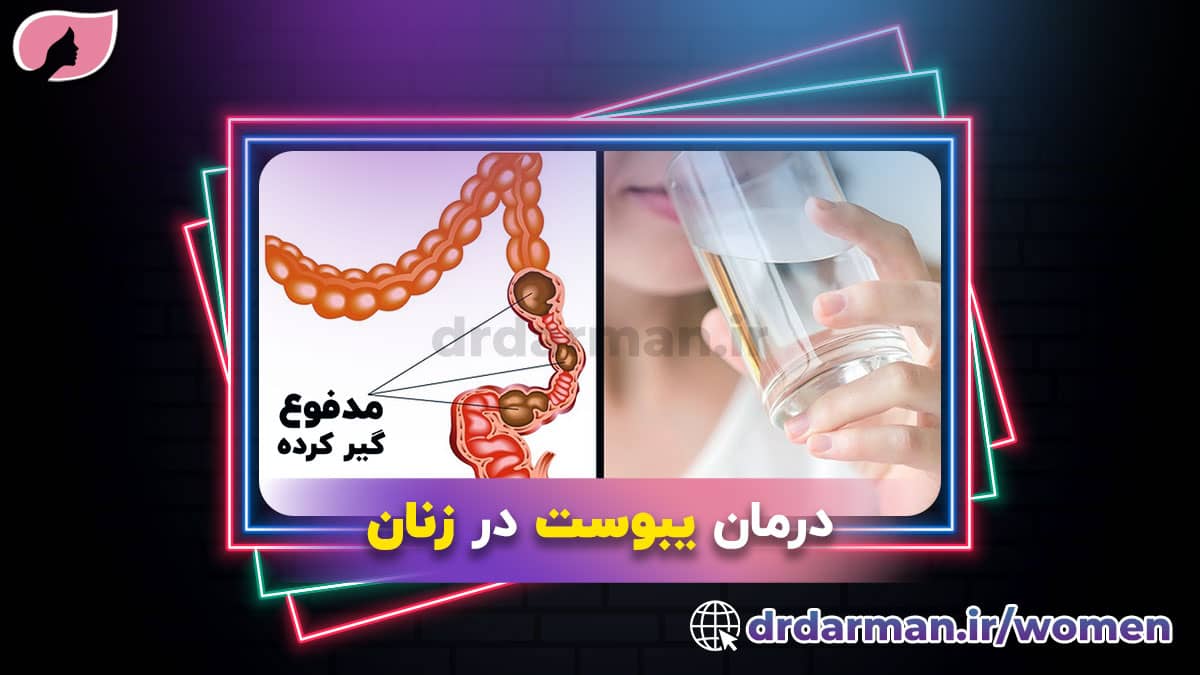 درمان یبوست در زنان
